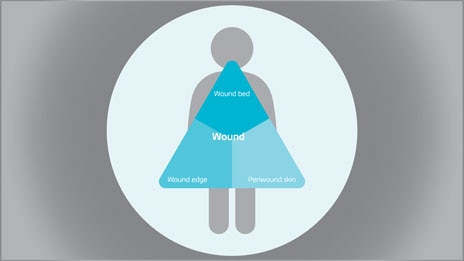 Benefits from the Triangle of Wound Assessment